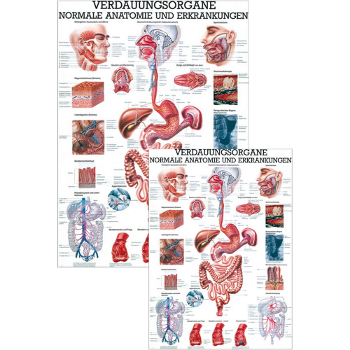 Öffne Lehrmittel "Verdauungsorgane - normale Anatomie u.  Erkrankungen"